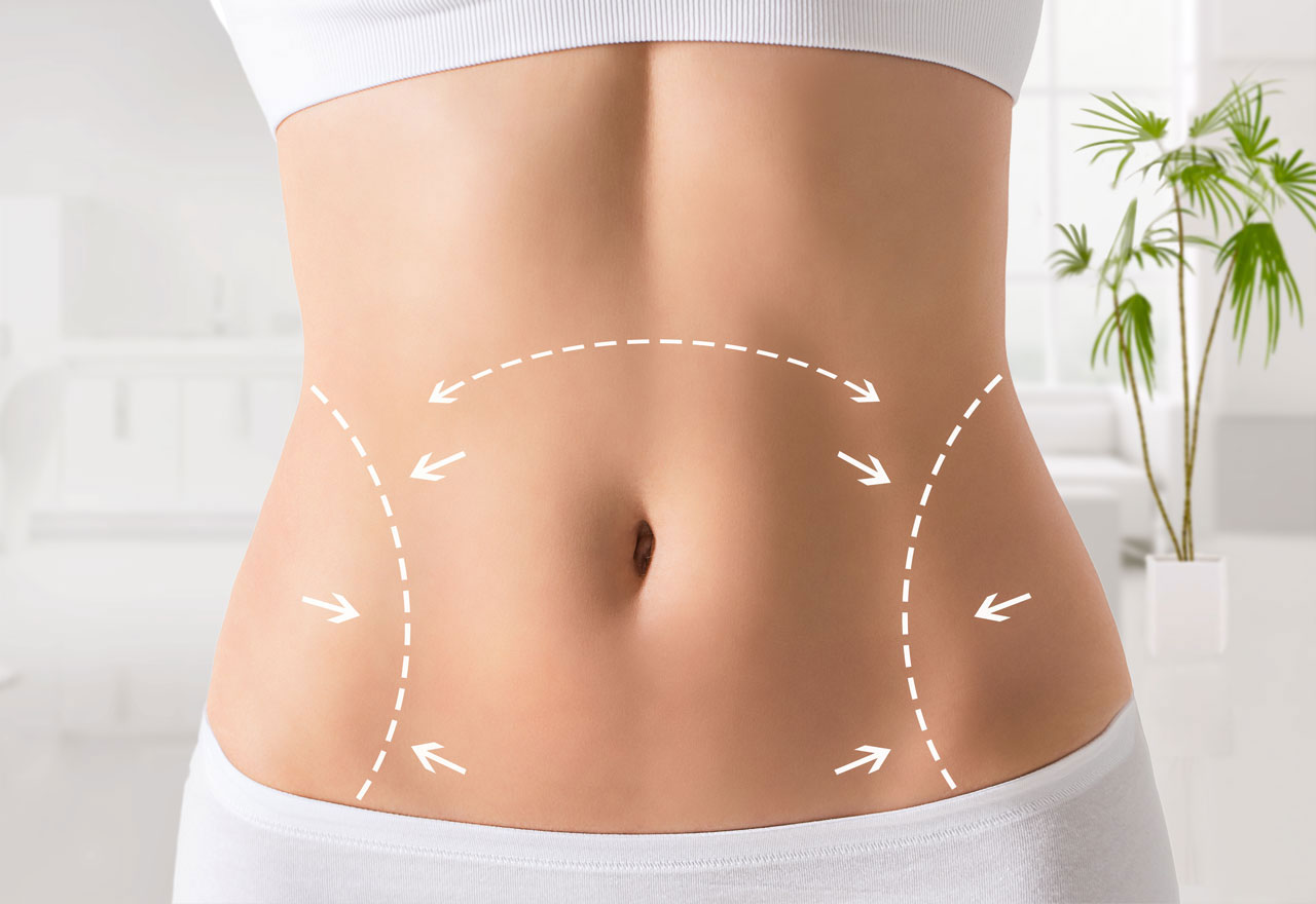 Bauchstraffung istanbul