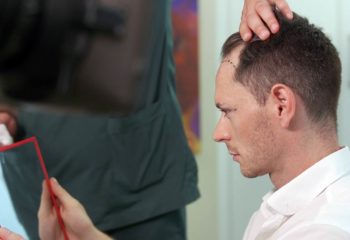 Haartransplantation Ablauf Istanbul
