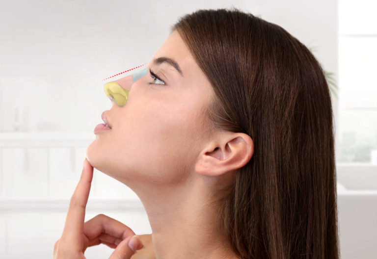 Nasen OP in der Türkei v3 Beauty Travels 24
