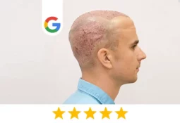 google-comment-yorick