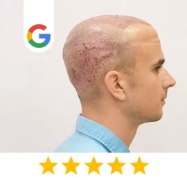 google-comment-yorick